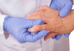 Rheumatoid arthritis patient